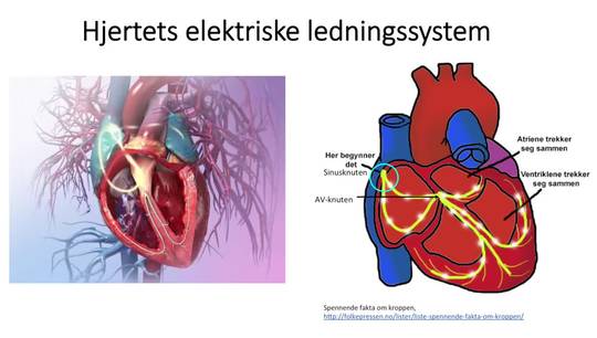 Link til Hjertets elektriske ledningssystem